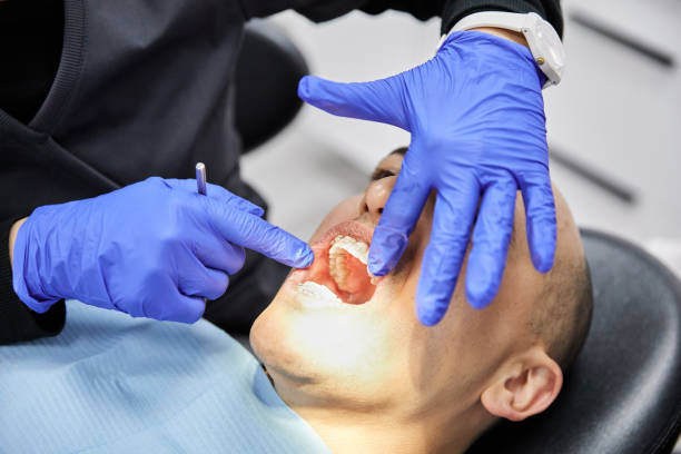 Best Emergency Root Canal Treatment in Burlington, OH