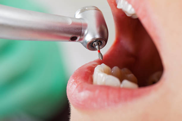Best Pediatric Emergency Dentist in Burlington, OH